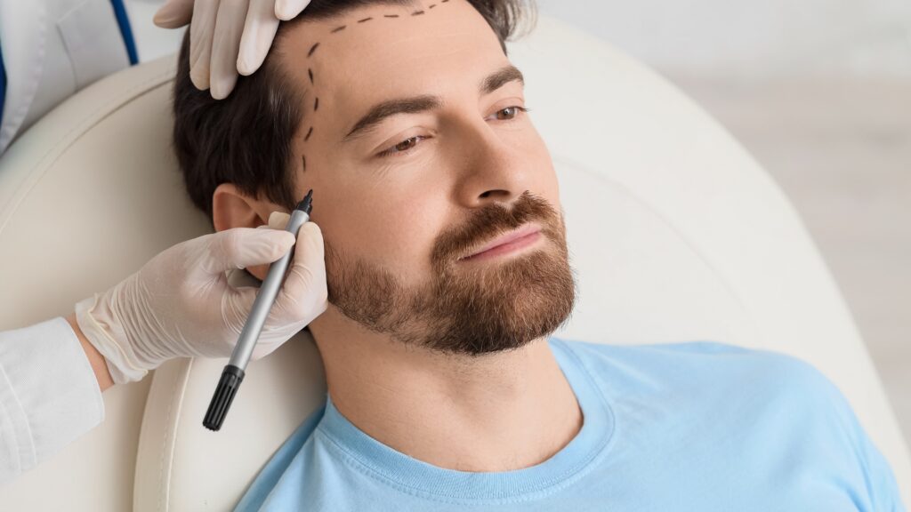 Laser Skin Treatments in India by morningsun