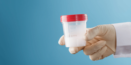 Semen Analysis Report by morningsun