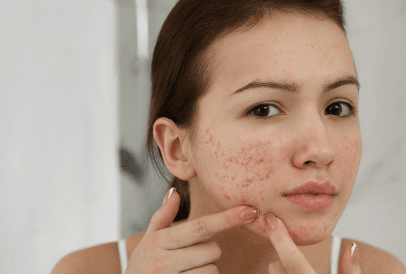 Skinfinity Derma Delhi/NCR