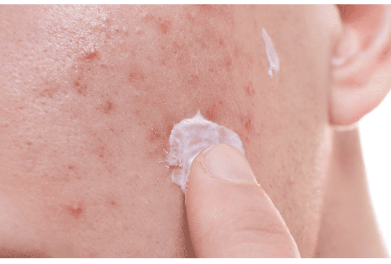 Skinfinity Derma Delhi/NCR